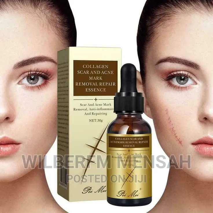 Collagen Scar Acne Removal Gel
