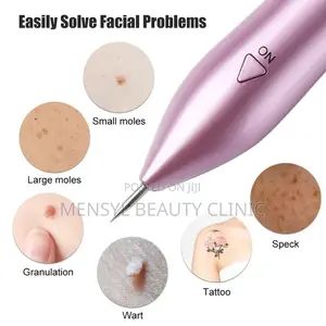 Plasma Pen for Skin Tag Removal,Stretch Marks and Tightening
