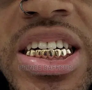 Hip-Hop Teeth /Grillz Teeth /Gold Teeth