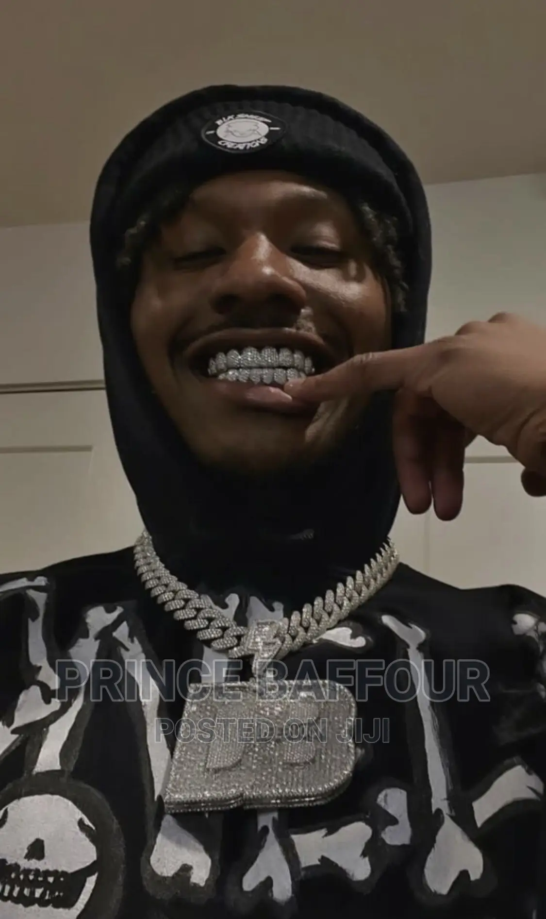 Hip-Hop Teeth /Grillz Teeth /Gold Teeth
