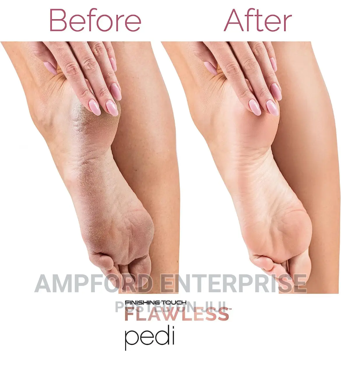 Electric Foot Grinder Pedicure