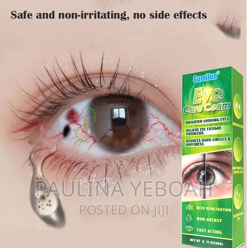 Eye Whitening Cream