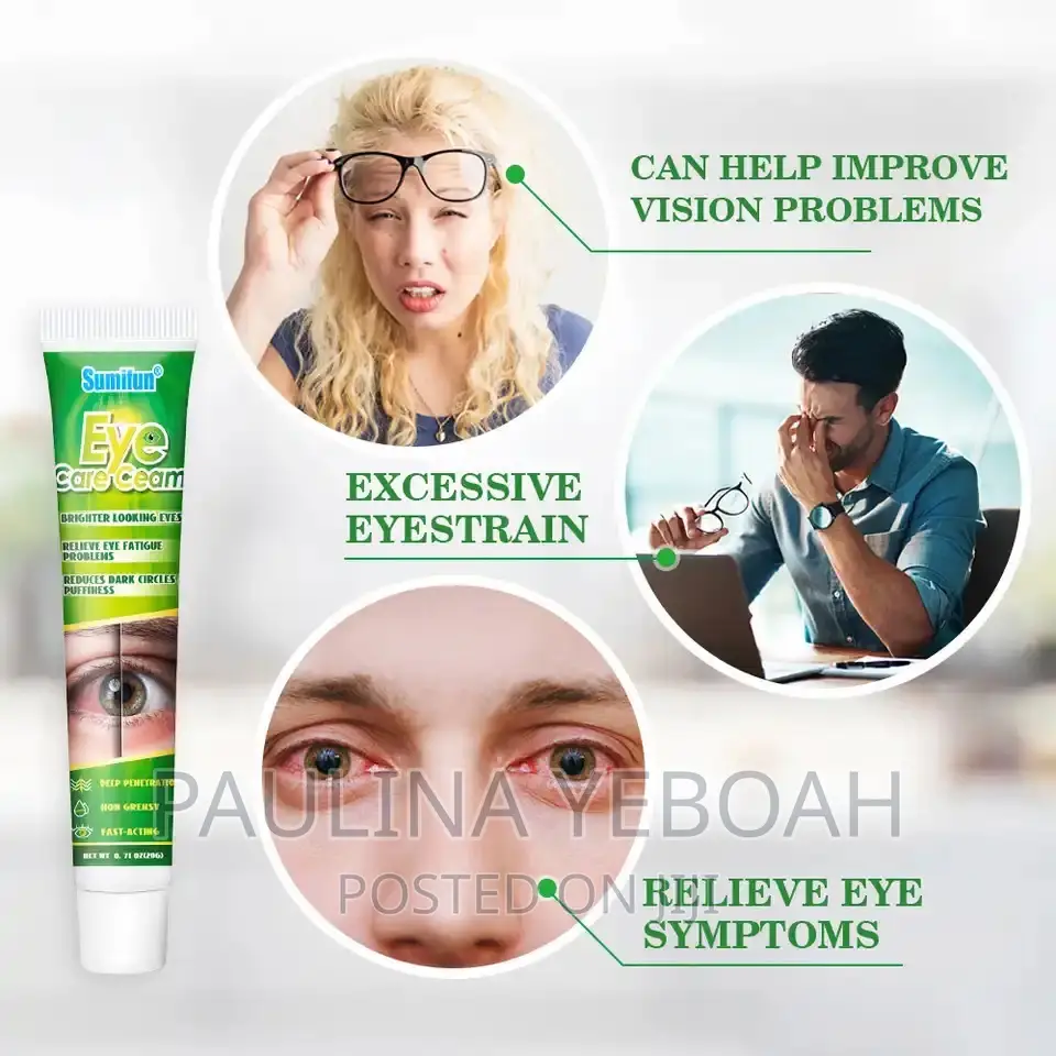 Eye Whitening Cream
