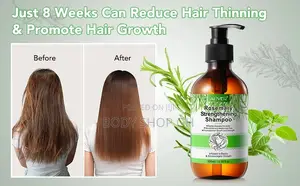 Rosemary Strengthening Shampoo With Biotin for Hair Growth