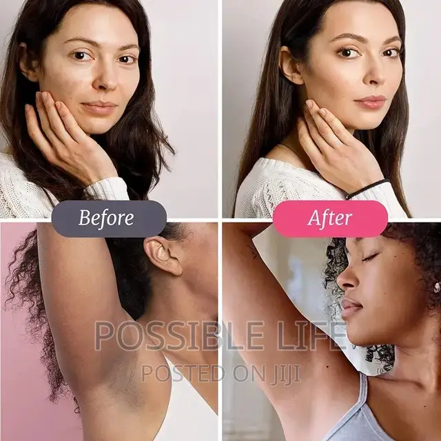 Skin Whitening and Spots Fading Tea. Brightening, Anti-Aging