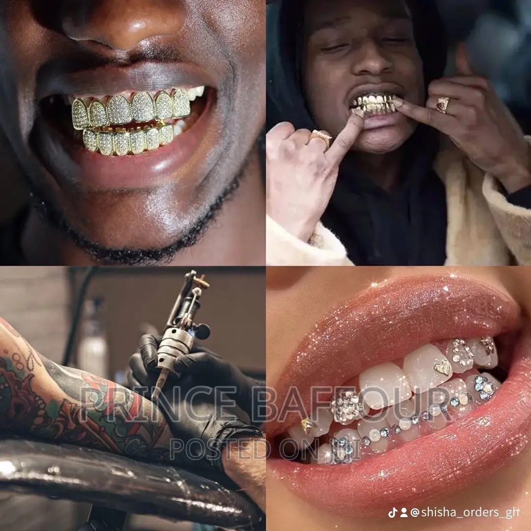 Hip-Hop Teeth /Grillz Teeth /Gold Teeth