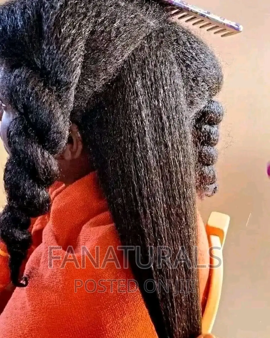 This Product Grows Hair Massively and Treats Dandruff
