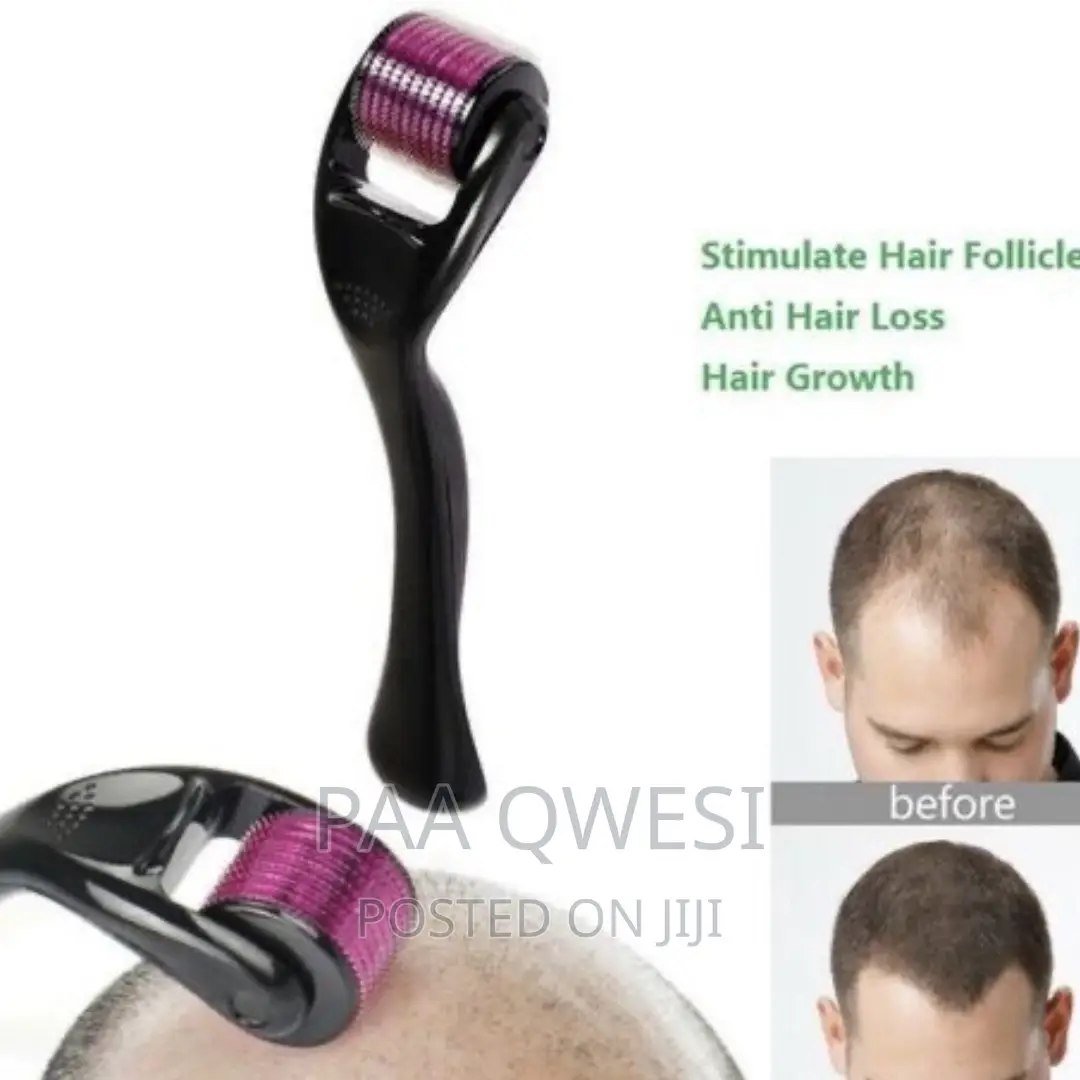 Derma Roller for Baldness Treatment