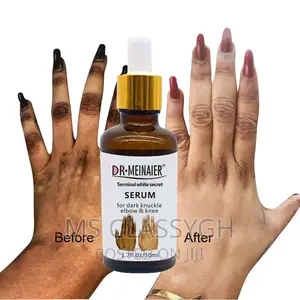 Body Face Whitening Cream Skin Lightening Bleaching Cream
