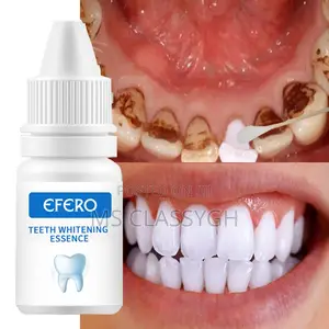 Efero Teeth Whitening Remove Stains Plaque Dental Cleaning