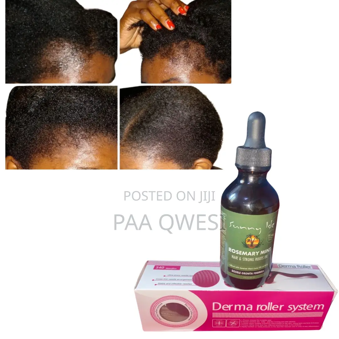 Rosemary Mint and Derma Roller