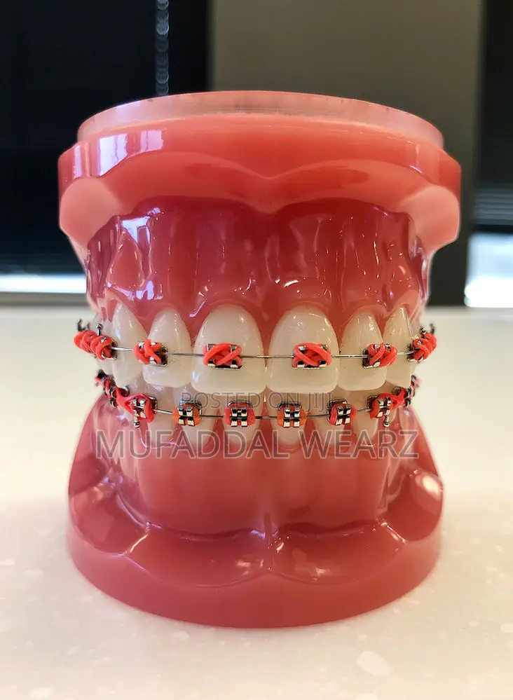 Perfect Your Smile With Braces and Aligners