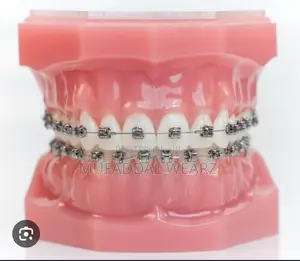 Perfect Your Smile With Braces and Aligners