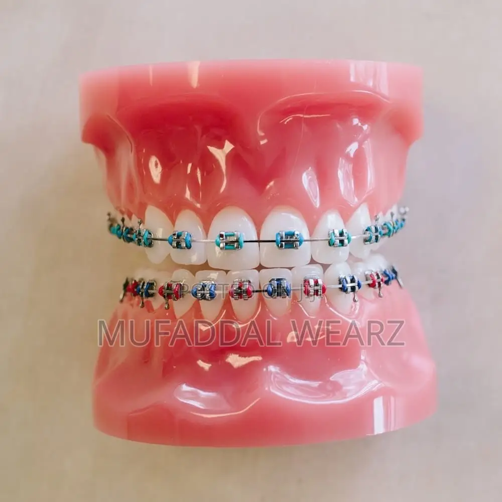 Perfect Your Smile With Braces and Aligners
