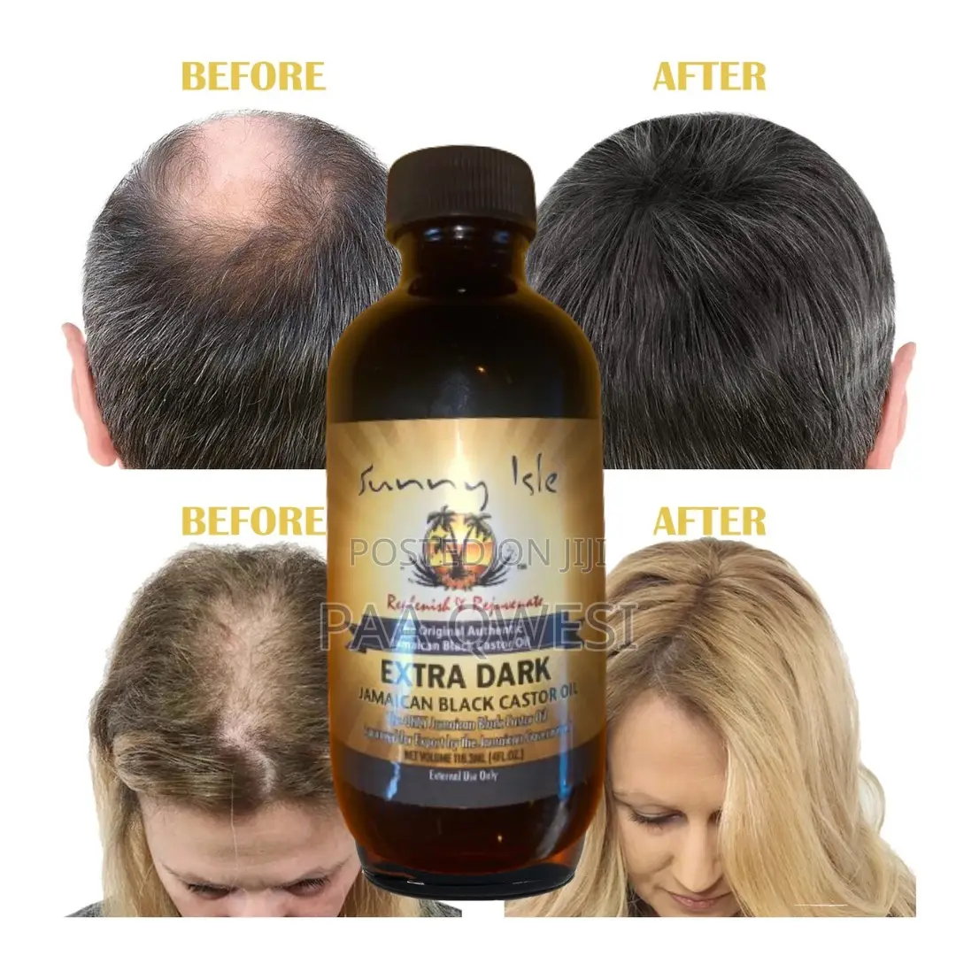 Purely Original Castor Oil for Hair Growth.