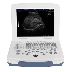 Brand New Dawei DW580 Scan With 1 Convex Probe