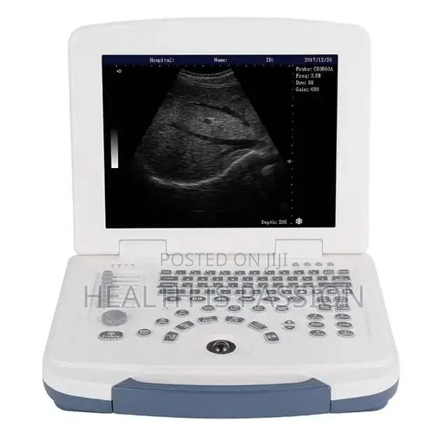 Brand New Dawei DW580 Scan With 1 Convex Probe