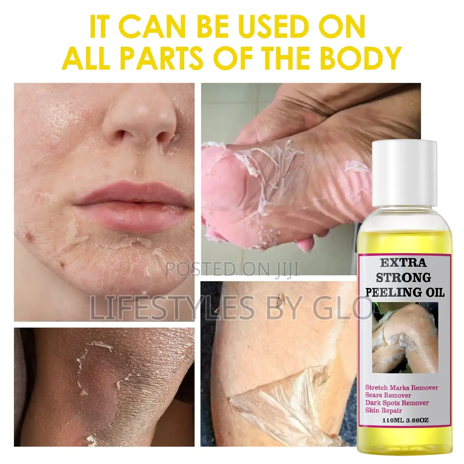Extra Strong Peeling Oil (Exfoliating Body Oil)