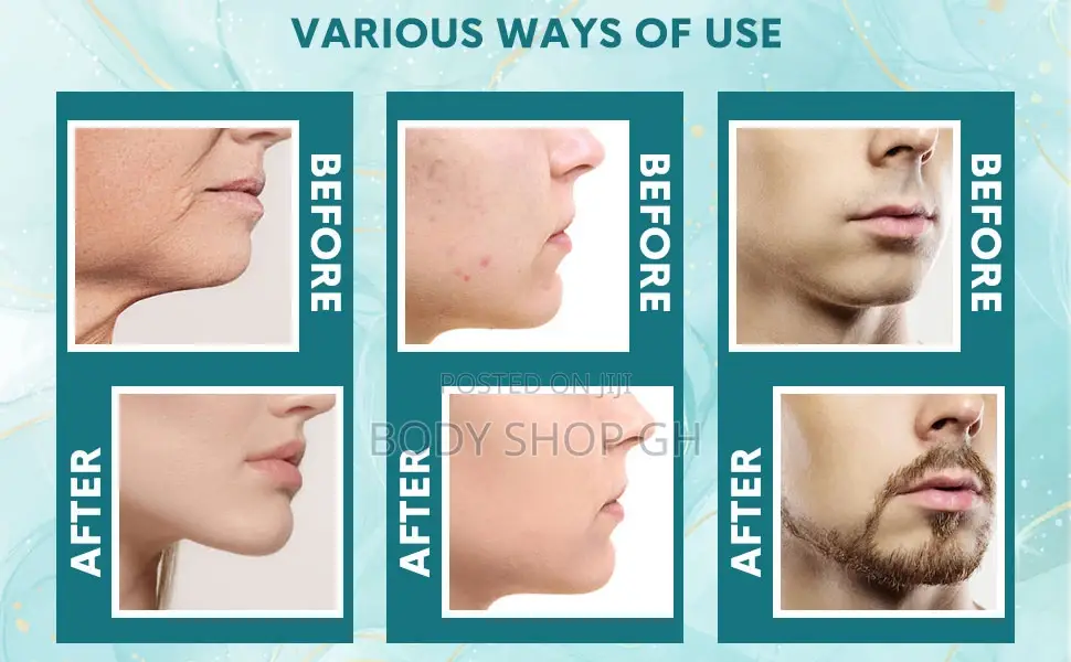 Derma Stamp -Adjustable Needle Size for Skin, Hair and Beard