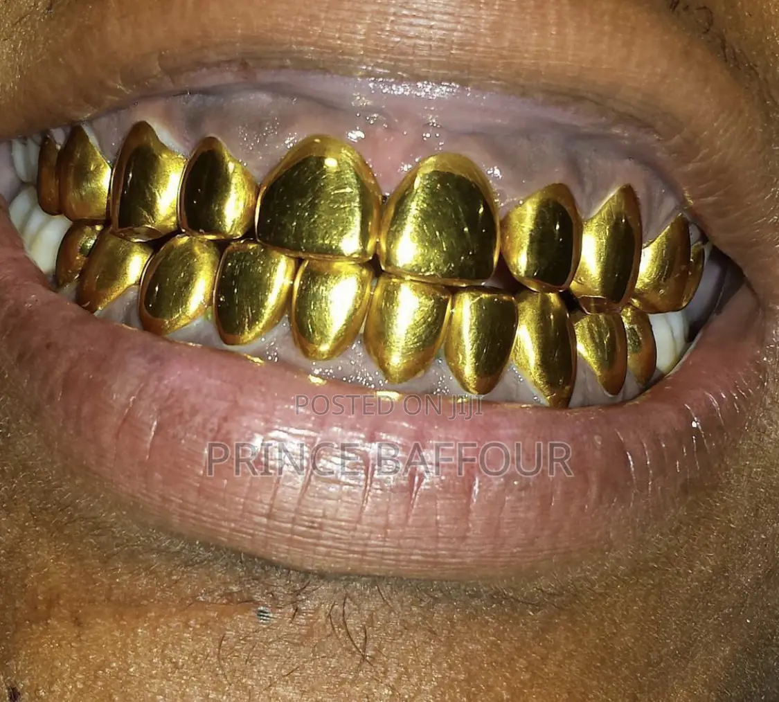 Hip-Hop Teeth /Grillz Teeth /Gold Teeth