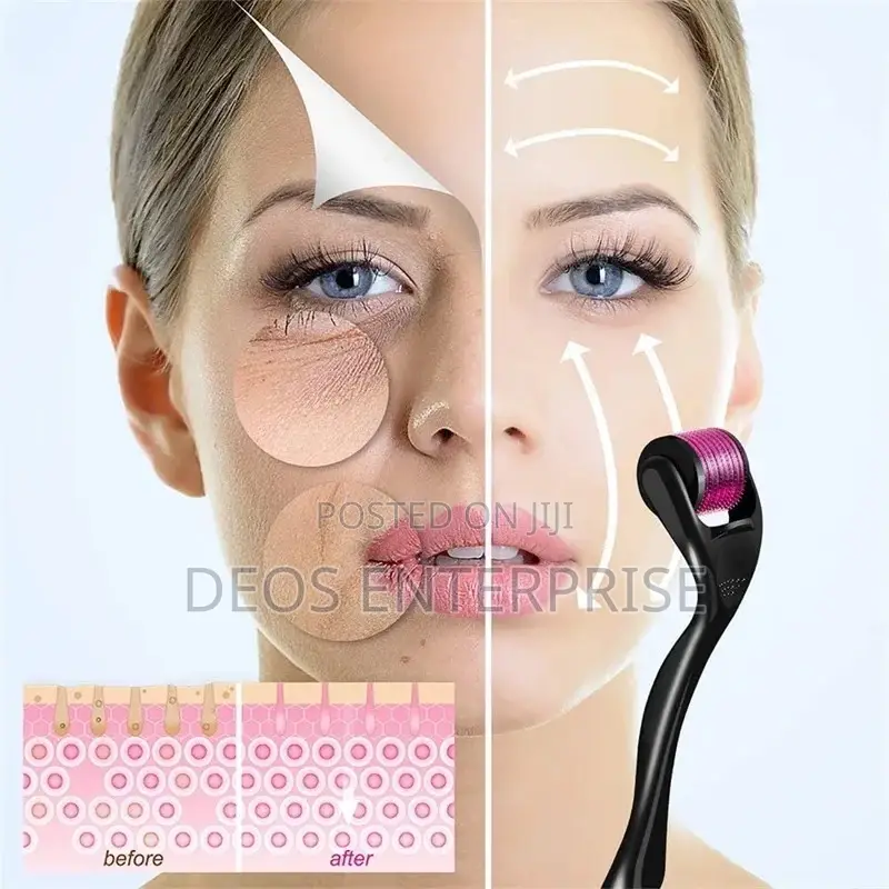 Most Used Derma Roller