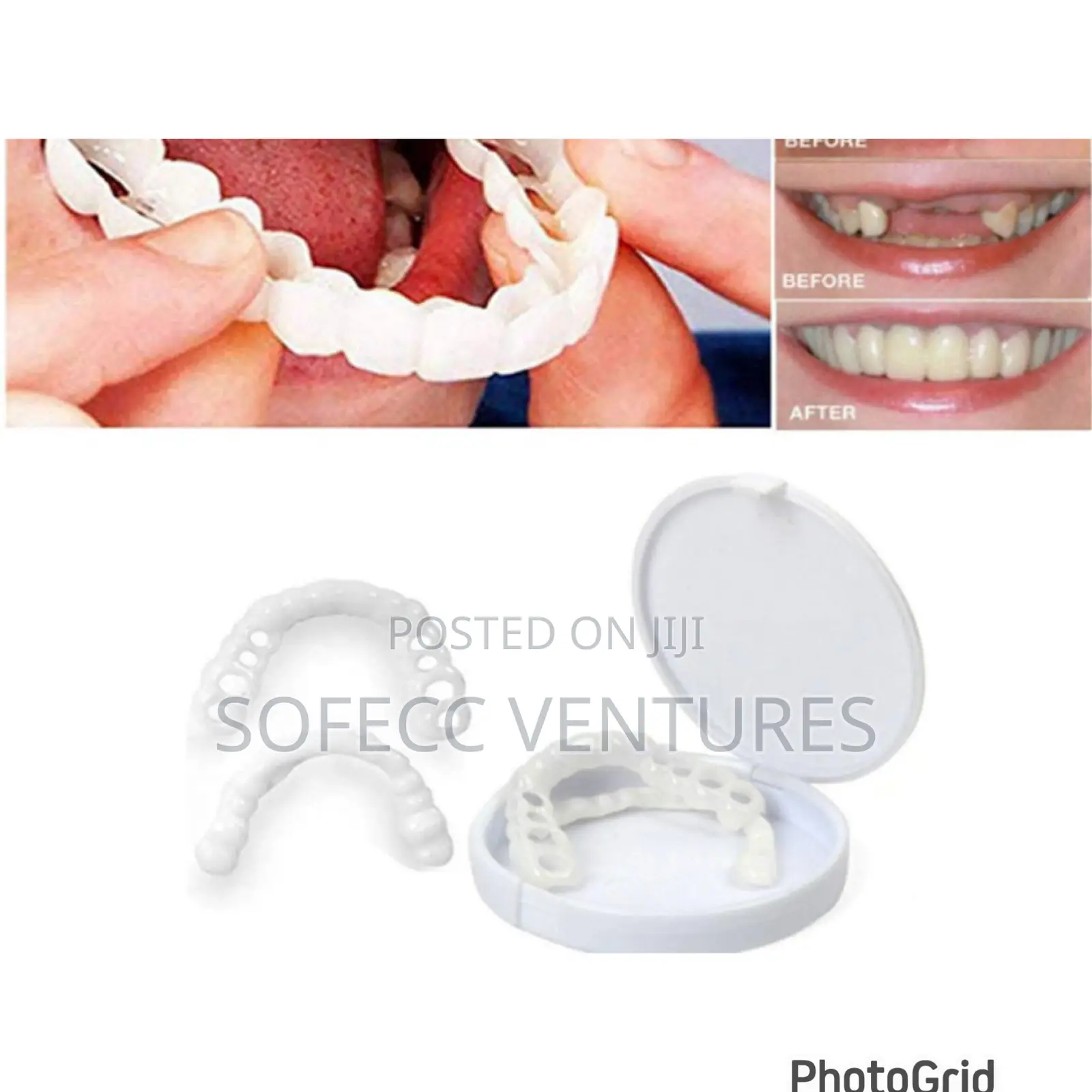 Simulated Braces/Fake Teeth