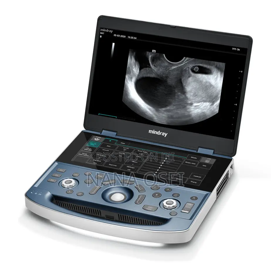 Mindray Z60 Ultrasound System With Convex Probe