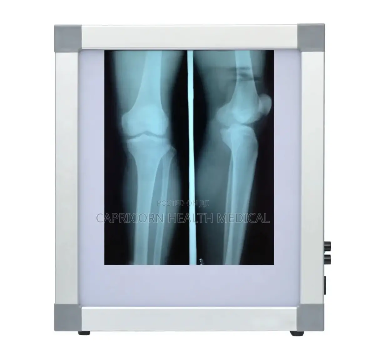 X Ray Viewer Single Panel