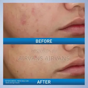 Cerave Acne Foaming Cream Wash