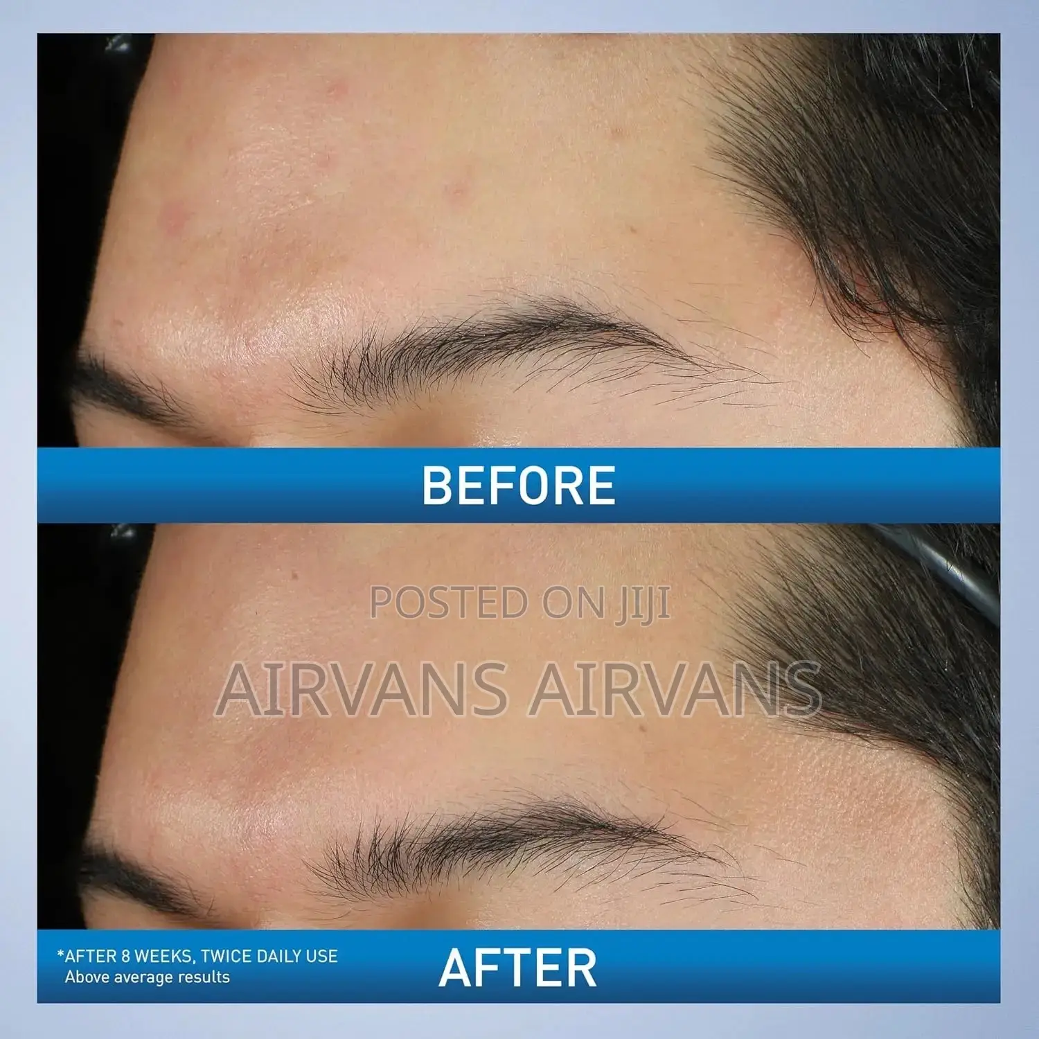 Cerave Acne Foaming Cream Wash