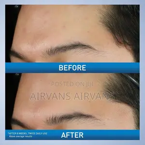 Cerave Acne Foaming Cream Wash