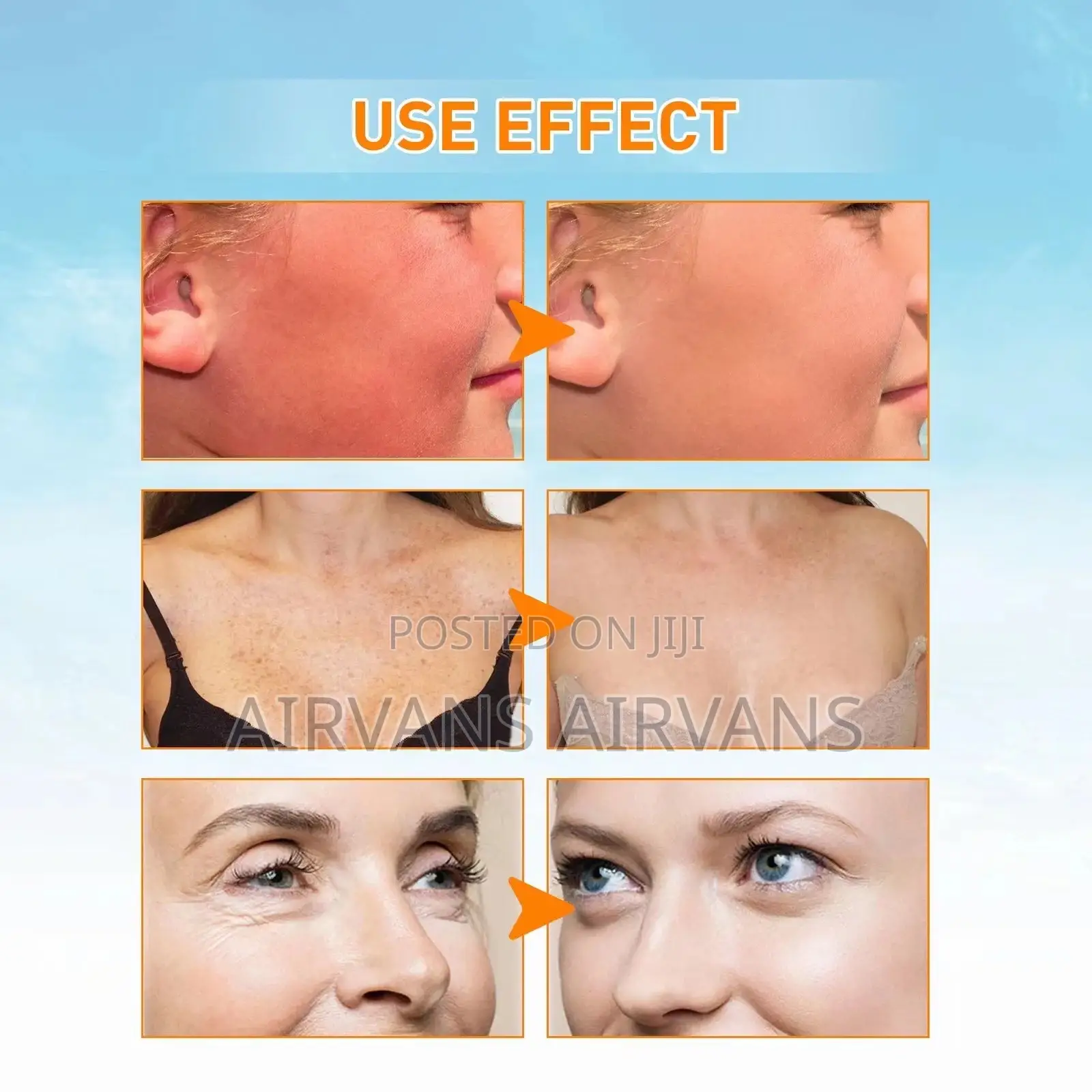 La Roche-posay Anthelios Uvmune 400 SPF 50