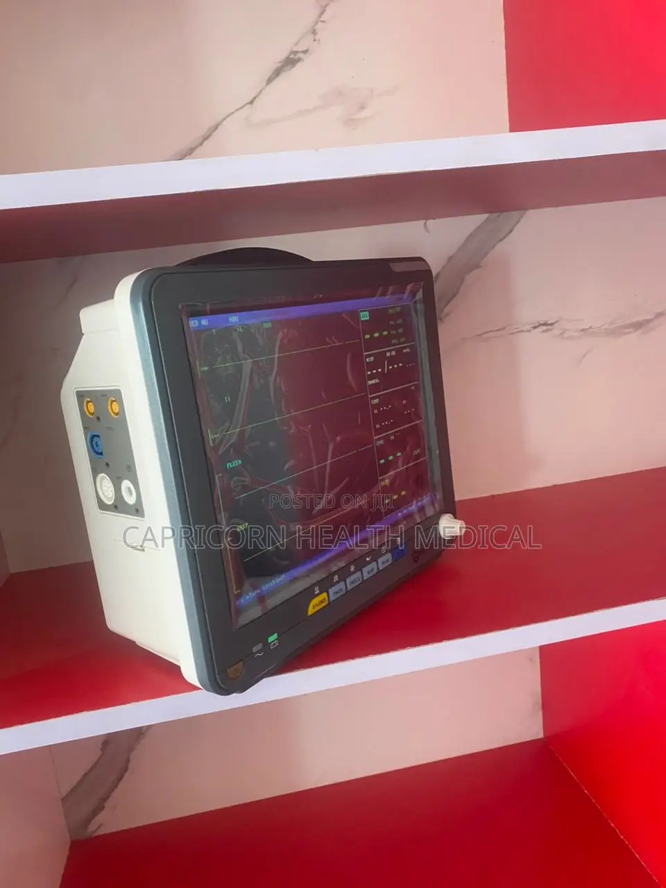 Patient Cardiac Monitor