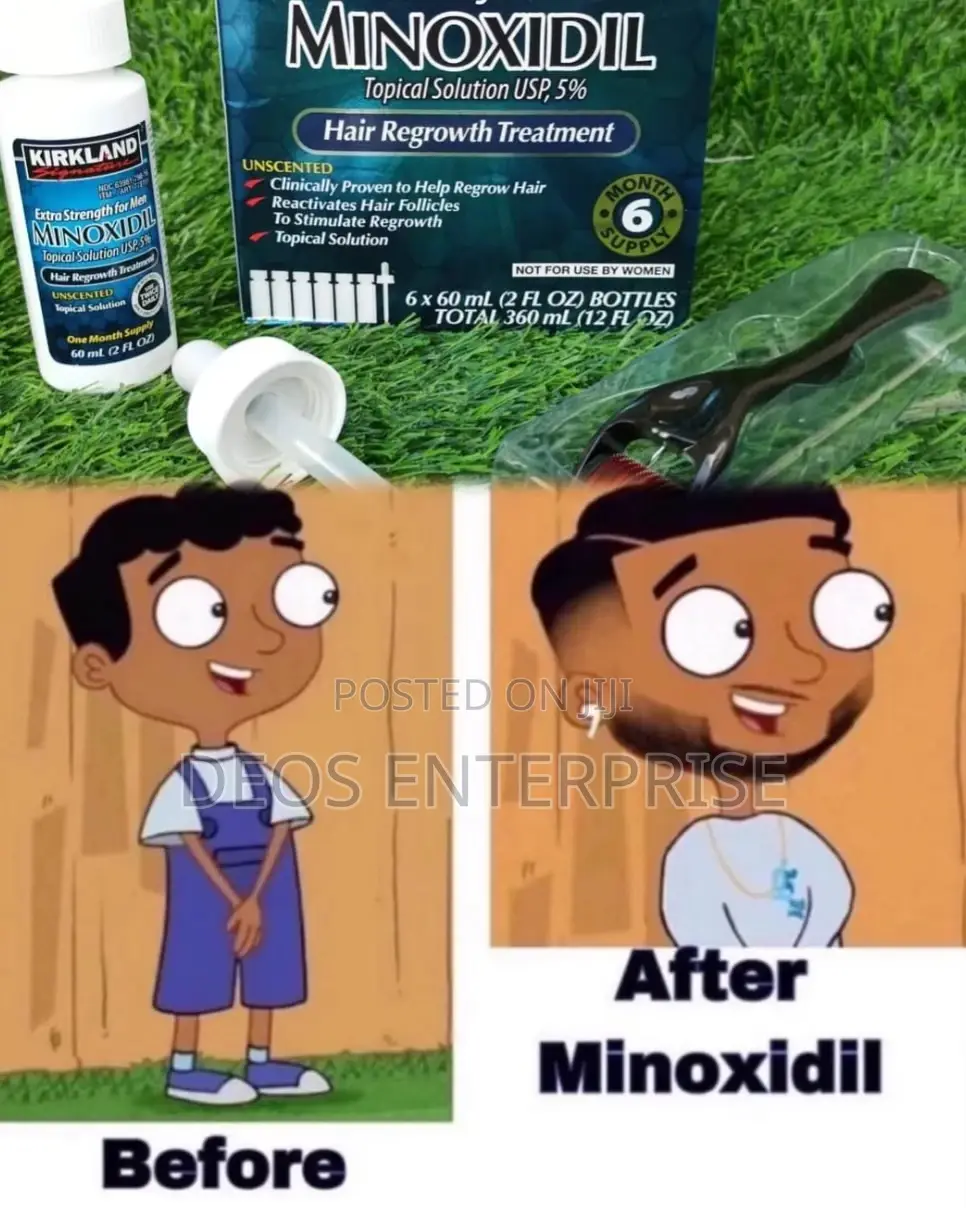 Kirkland Minoxidil Derma Roller Beard and Baldness Growth