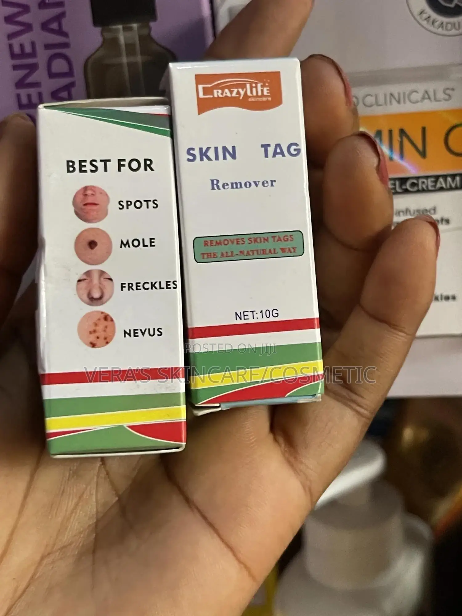 Skin Tag Removal