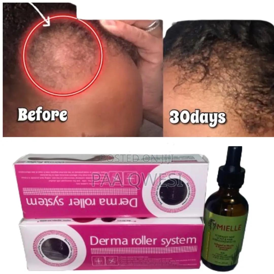 Mielle Derma Roller for Perfect Hair Growth