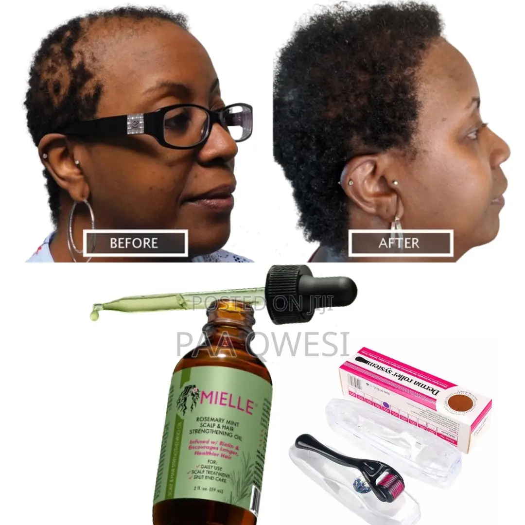 Super Hair Growth Combo(Mielle Rosemary Mint Roller)
