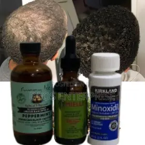 Effective Combo of Kirkland Mielle Peppermint for Hair