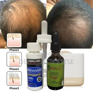 Best Super Great Combo for Hair Loss
