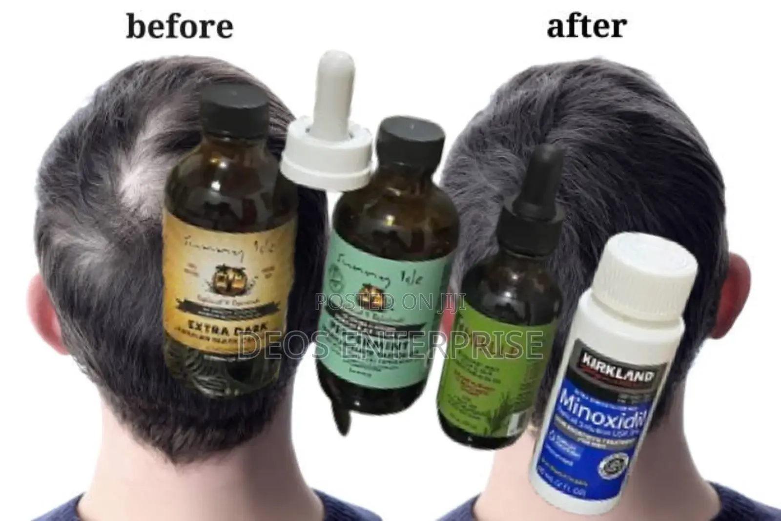 Castor Oil Peppermint Mielle Organics Kirkland