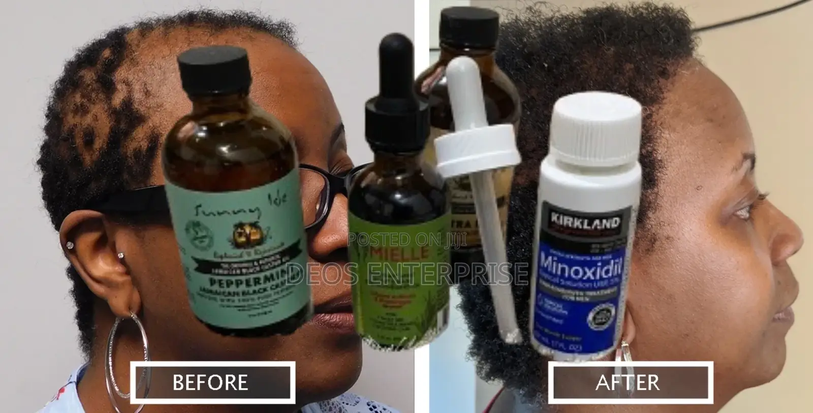 Affordable Quality Hair Loss Growth Products