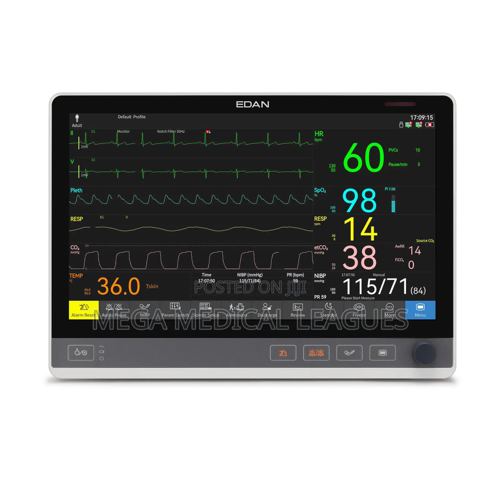 Edan CX Seris (UX Seris) Patient Monitor CX10/12/15