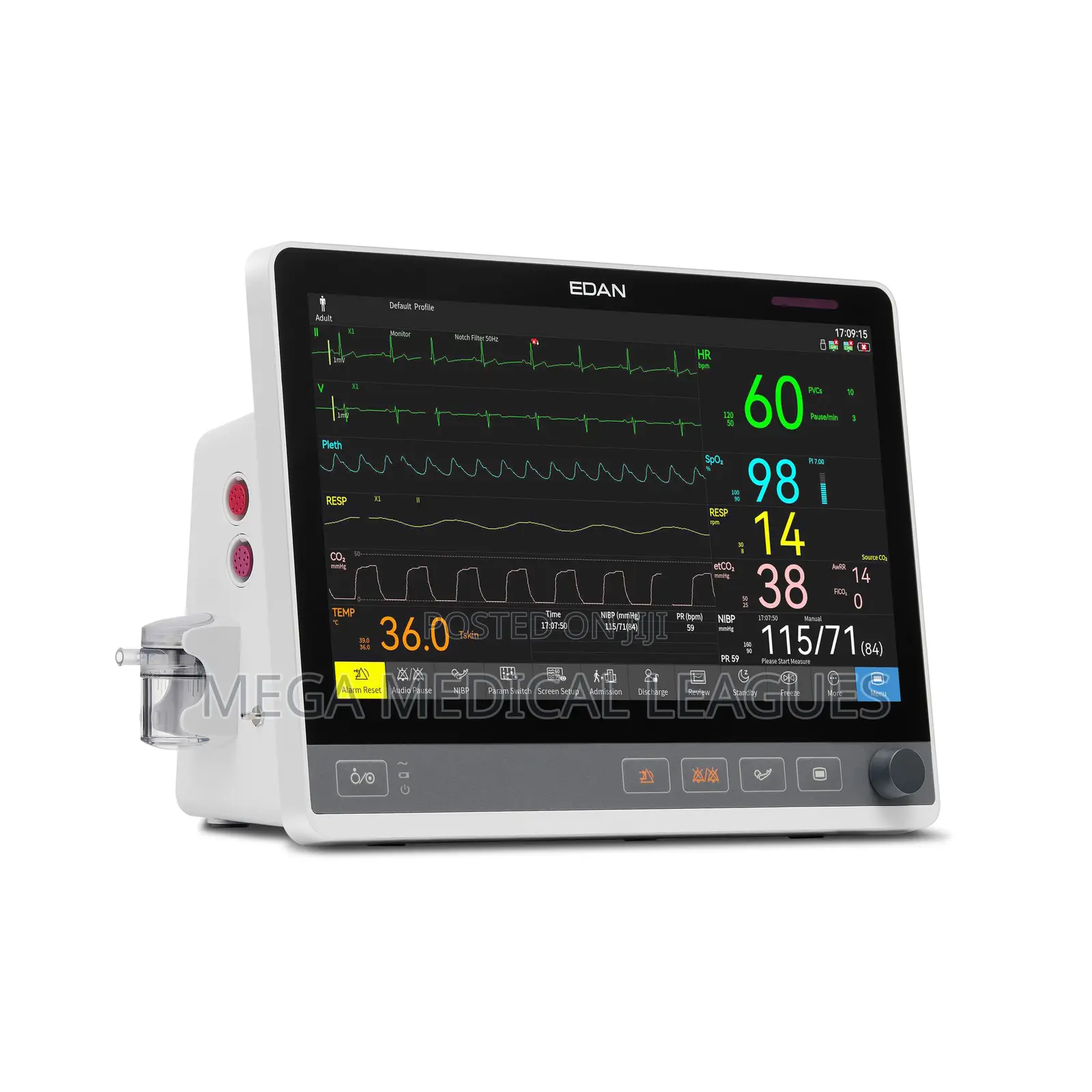 Edan CX Seris (UX Seris) Patient Monitor CX10/12/15