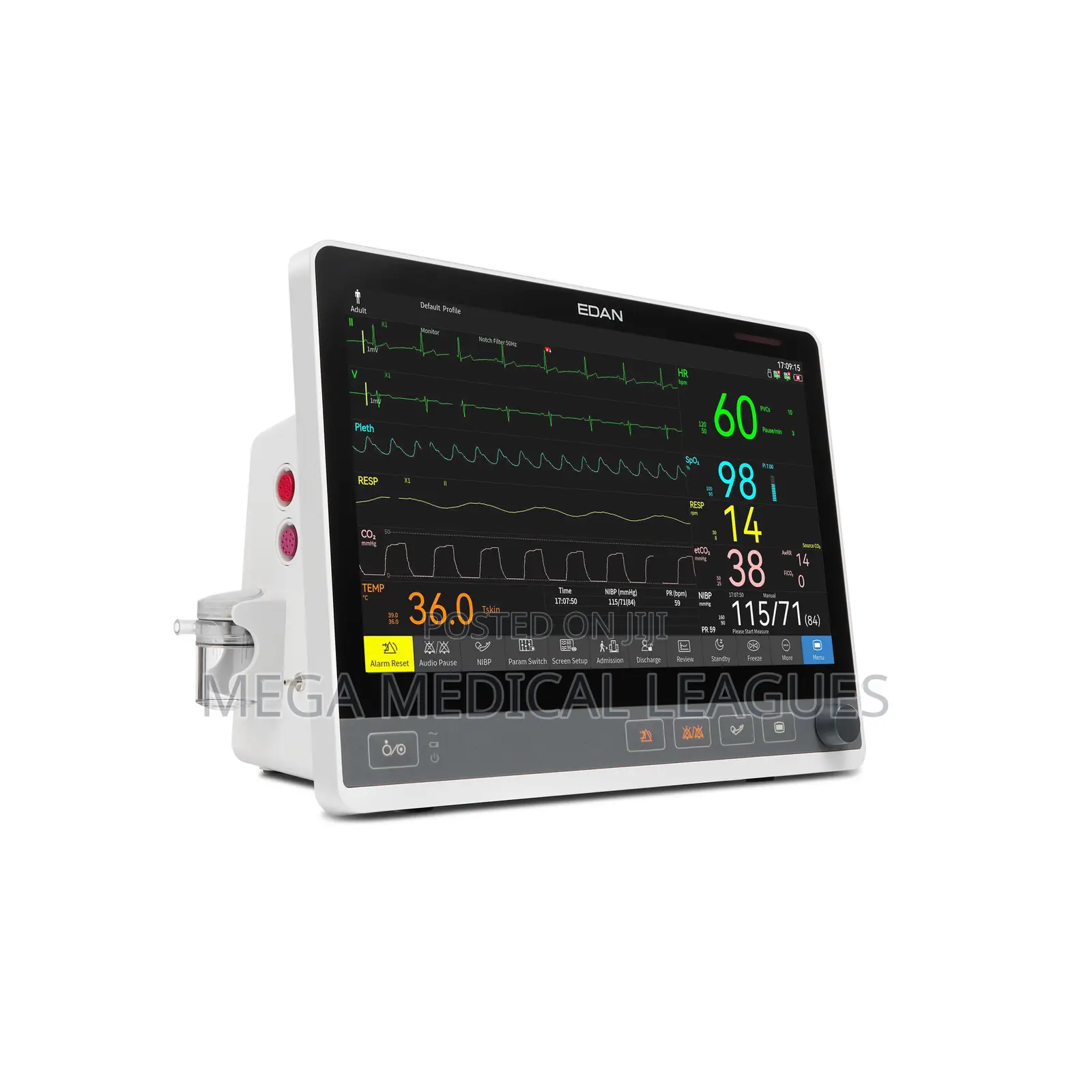 Edan CX Seris (UX Seris) Patient Monitor CX10/12/15