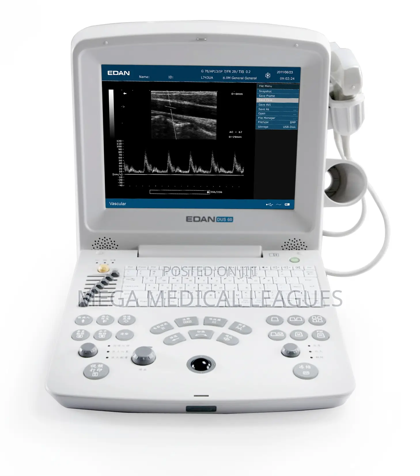 Edan DUS60 Black and White Ultrasound