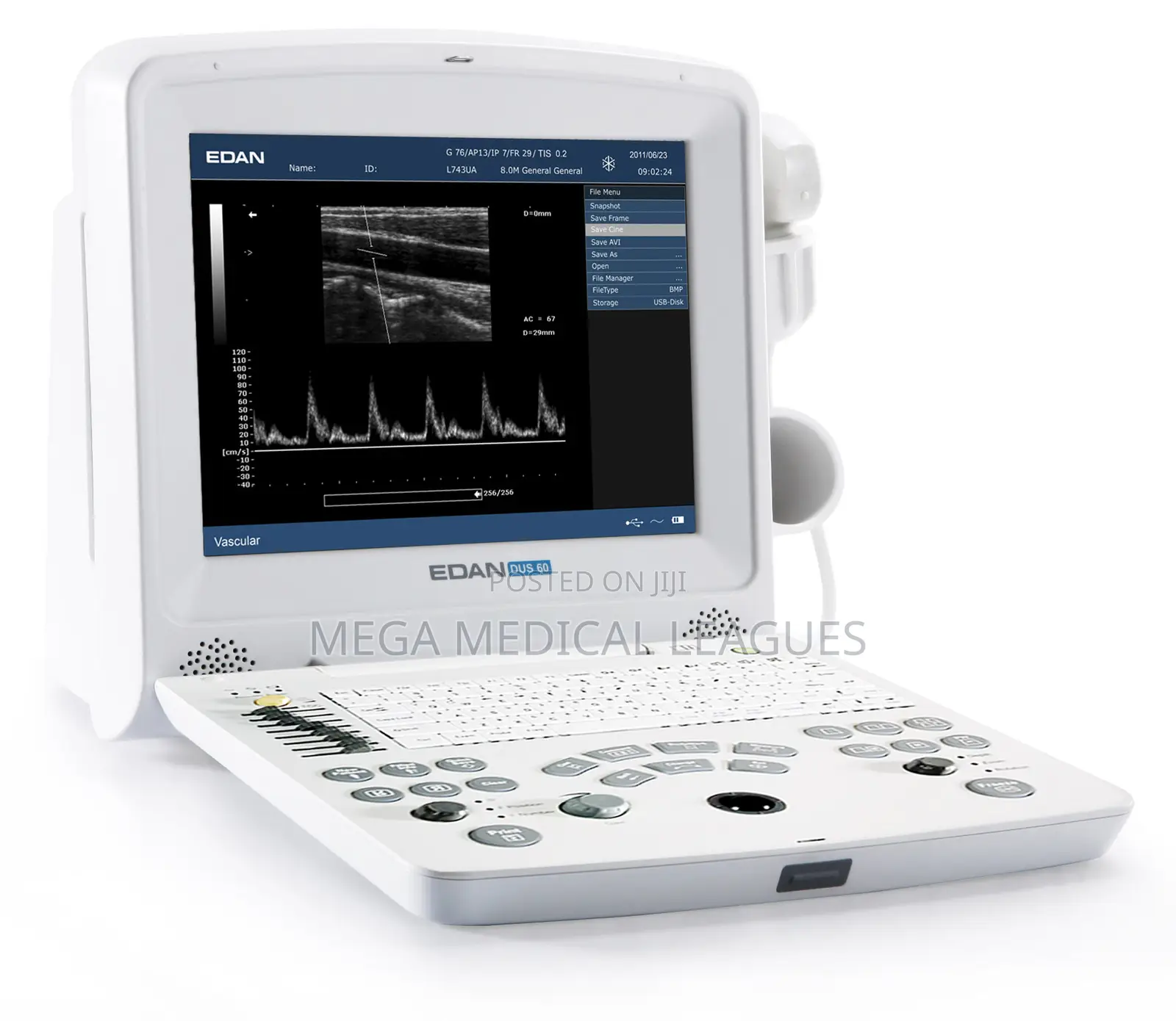 Edan DUS60 Black and White Ultrasound