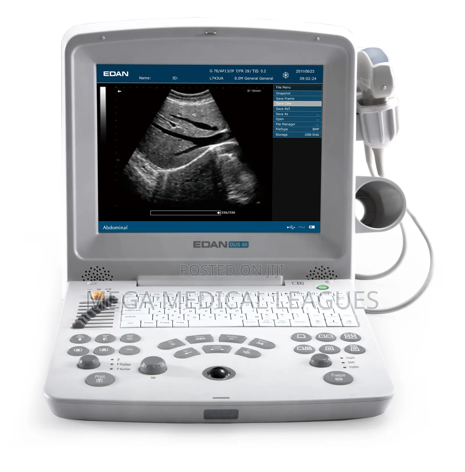 Edan DUS60 Black and White Ultrasound