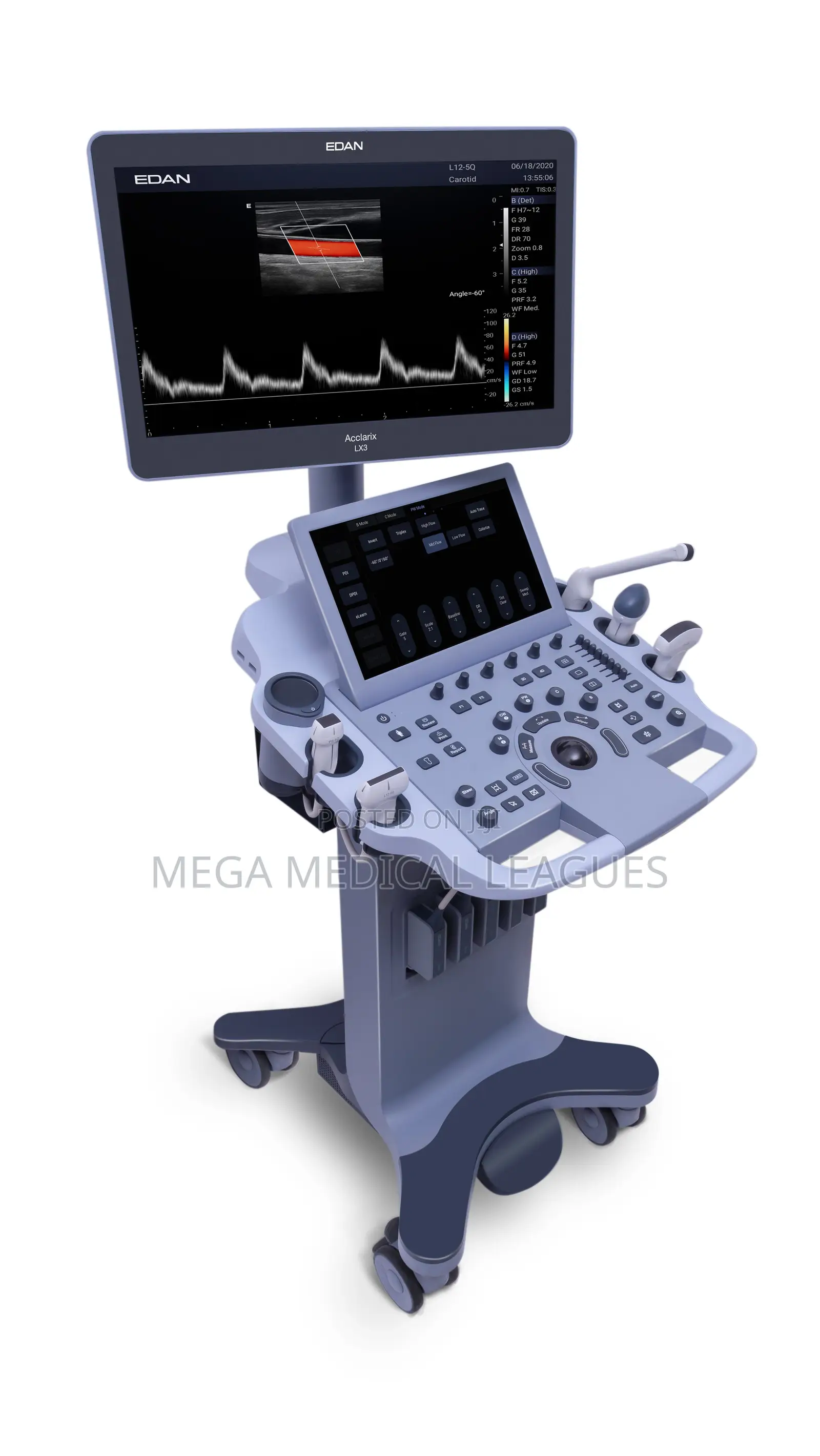 Edan Lx3 4D Ultrasound Machine