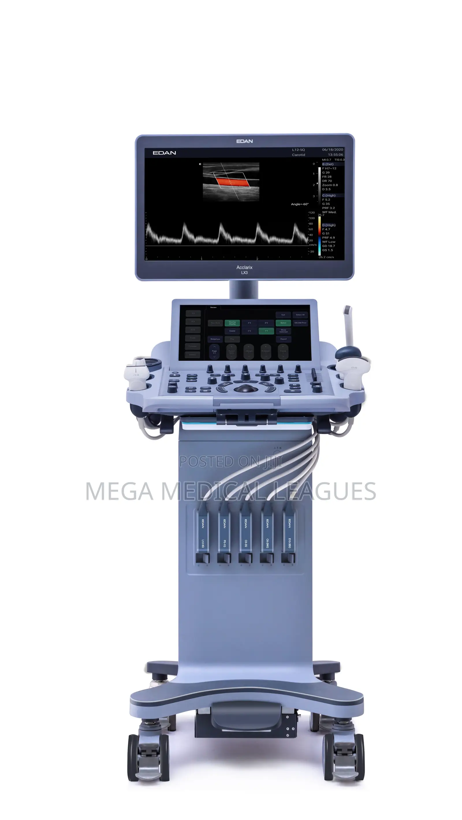 Edan Lx3 4D Ultrasound Machine