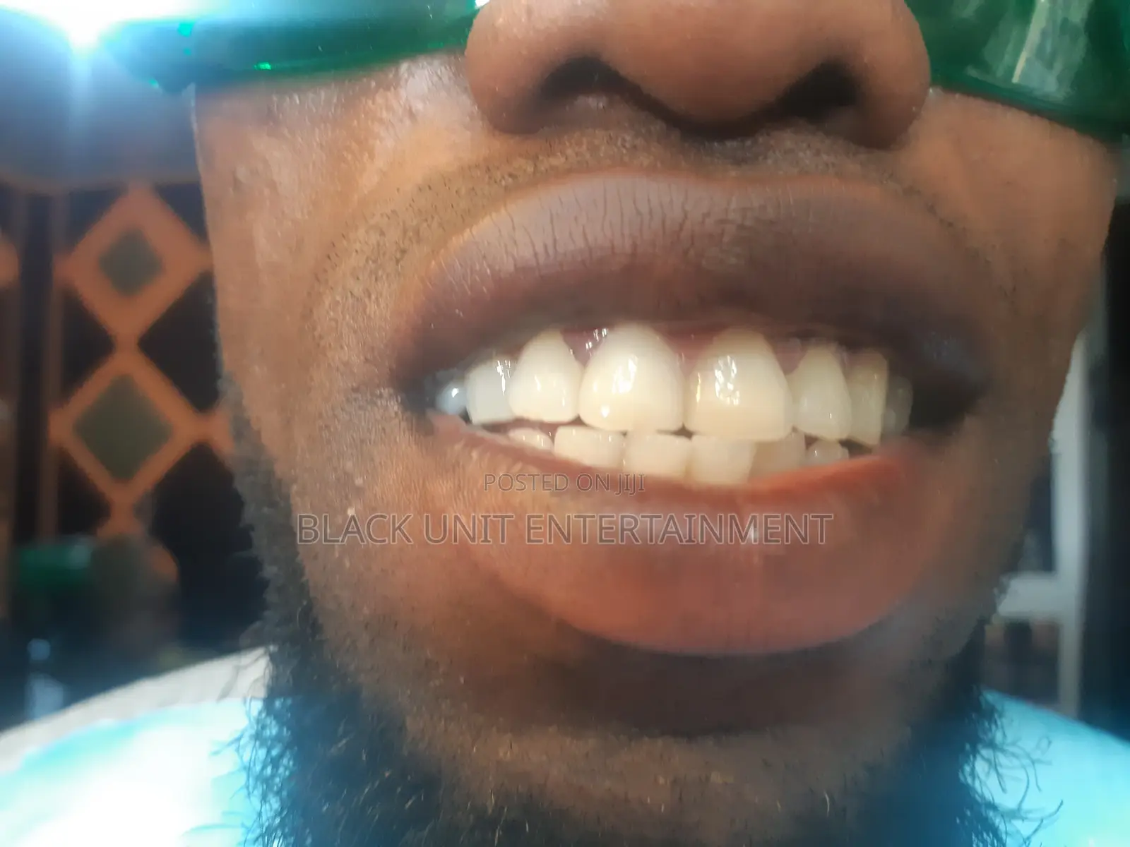 Teeth Whitening Studio